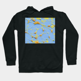 Pluripotent derived neurones, SEM, (C055/8975) Hoodie